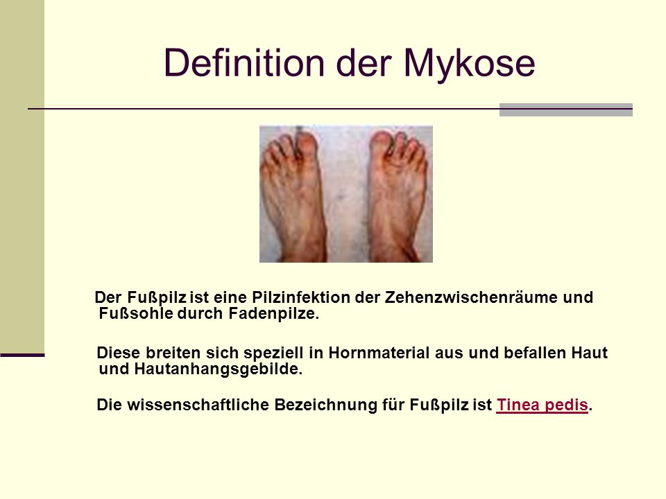 Gribka auf den Nägeln die Niednägel